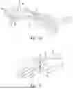 Fig. 08 - Device for Fixating Orthopedic Injury