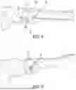 Fig. 07 - Device for Fixating Orthopedic Injury