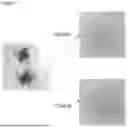 Fig. 02 - PHARMACEUTICAL COMPOSITION FOR TREATING AND/OR PREVENTING RENAL CYSTIC CILIOPATHY