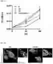 Fig. 02 - ENDOPLASMIC RETICULUM PROTEIN HYOU1-BINDING COMPOUND FOR INHIBITING ENDOPLASMIC RETICULUM-MITOCHONDRIAL INTERACTION AND USES THEREOF