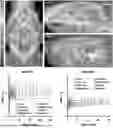 Fig. 01 - METHODS OF DIAGNOSING AND TREATING NEURODEGENERATIVE DISEASES