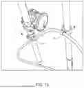 Fig. 11 - Security Lock for Poles and Rods