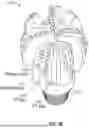 Fig. 04 - REFRESHABLE POLYCRYSTALLINE DIAMOND COMPACT (PDC) DRILL BITS