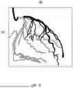 Fig. 04 - METHOD AND APPARATUS FOR PROCESSING VASCULAR IMAGE BASED ON BLOOD VESSEL SEGMENTATION