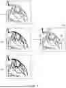 Fig. 06 - METHOD AND APPARATUS FOR PROCESSING VASCULAR IMAGE BASED ON BLOOD VESSEL SEGMENTATION