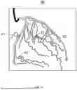 Fig. 07 - METHOD AND APPARATUS FOR PROCESSING VASCULAR IMAGE BASED ON BLOOD VESSEL SEGMENTATION