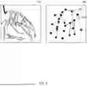 Fig. 08 - METHOD AND APPARATUS FOR PROCESSING VASCULAR IMAGE BASED ON BLOOD VESSEL SEGMENTATION