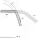 Fig. 09 - METHOD AND APPARATUS FOR PROCESSING VASCULAR IMAGE BASED ON BLOOD VESSEL SEGMENTATION