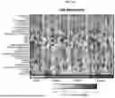 Fig. 149 - Methods and Compositions for Assessing and Treating Lupus