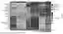 Fig. 30 - Methods and Compositions for Assessing and Treating Lupus