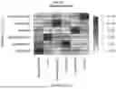 Fig. 55 - Methods and Compositions for Assessing and Treating Lupus
