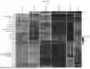 Fig. 64 - Methods and Compositions for Assessing and Treating Lupus