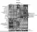 Fig. 71 - Methods and Compositions for Assessing and Treating Lupus