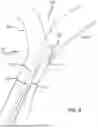 Fig. 10 - Steerable Fiber Optic Shape Sensing Enabled Elongated Medical Instrument