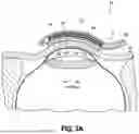 Fig. 04 - METHOD OF MEASURING SEDATIN USING OCULAR MICROTREMOR (OMT) AND MICROSACCADES (MS)