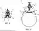 Fig. 03 - PRESSURE DELIVERY DEVICE FOR HEMORRHAGE CONTROL