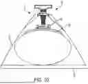 Fig. 07 - PRESSURE DELIVERY DEVICE FOR HEMORRHAGE CONTROL