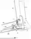 Fig. 02 - PATIENT-SPECIFIC INSTRUMENTATION AND METHODS FOR ANKLE ARTHROPLASTY