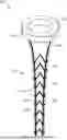 Fig. 01 - MEDICAL DEVICE FOR ACCESSING THE CENTRAL NERVOUS SYSTEM