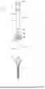 Fig. 04 - MEDICAL DEVICE FOR ACCESSING THE CENTRAL NERVOUS SYSTEM