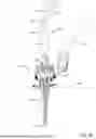 Fig. 35 - MEDICAL DEVICE FOR ACCESSING THE CENTRAL NERVOUS SYSTEM