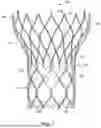 Fig. 02 - Rotating Capsule for Commissure Alignment