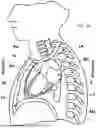 Fig. 02 - Coaptation of the Mitral Valve Using a Tether That Runs from within the Right Atrium to an Outer Wall of the Left Ventricle