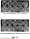 Fig. 03 - SOLUBLE MICRONEEDLE FOR LOCAL ANESTHESIA AND LOCAL ANESTHESIA PATCH COMPRISING SAME