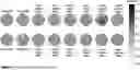 Fig. 01 - METHOD OF TREATMENT AND SELECTION OF PATIENTS BENEFITING FROM AGOMELATINE BASED ON EEG MEASUREMENTS