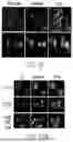 Fig. 47 - COMBINATION THERAPIES FOR MODULATION OF LIPID PRODUCTION