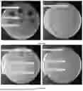 Fig. 09 - PARTICLE COMPRISING A VIRUS
