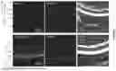 Fig. 02 - Materials & Methods for Treatment of Macular Degeneration