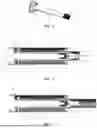 Fig. 03 - Syringe Assembly with Automatic Safety Sleeve