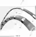 Fig. 08 - INTRA-LUMINAL MULTI-SITE BIO-STIMULATION, SENSING & MAPPING DEVICE WITH AUTO FEEDBACK