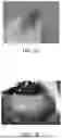 Fig. 09 - INTRA-LUMINAL MULTI-SITE BIO-STIMULATION, SENSING & MAPPING DEVICE WITH AUTO FEEDBACK
