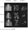 Fig. 06 - COMPOSITIONS AND METHODS FOR TARGETED THERAPEUTIC DELIVERY TO BONE