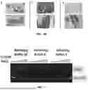 Fig. 13 - COMPOSITIONS AND METHODS FOR TARGETED THERAPEUTIC DELIVERY TO BONE