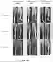 Fig. 23 - COMPOSITIONS AND METHODS FOR TARGETED THERAPEUTIC DELIVERY TO BONE
