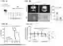 Fig. 06 - TREATMENT OF BRAIN METASTASIS