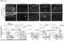Fig. 09 - TREATMENT OF BRAIN METASTASIS