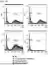 Fig. 30 - TREATMENT OF BRAIN METASTASIS