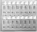 Fig. 01 - APPLICATION OF BLOOD GROUP ANTIGEN TRISACCHARIDE CONJUGATES IN THE DETECTION OF BLOOD GROUP ANTIBODIES