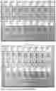 Fig. 02 - APPLICATION OF BLOOD GROUP ANTIGEN TRISACCHARIDE CONJUGATES IN THE DETECTION OF BLOOD GROUP ANTIBODIES