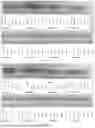 Fig. 10 - APPLICATION OF BLOOD GROUP ANTIGEN TRISACCHARIDE CONJUGATES IN THE DETECTION OF BLOOD GROUP ANTIBODIES