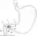 Fig. 01 - DEVICES, SYSTEMS, AND METHODS FOR OCCLUDING AN ANATOMICAL PASSAGE