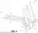 Fig. 06 - UNIVERSAL FASTENER TIGHTENING TOOL STRUCTURALLY CONFIGURED TO ENGAGE DIFFERENT FASTENER TYPES AND/OR MITIGATE AGAINST ACCESS