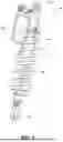 Fig. 04 - SMART DEVICE APPLICATION WITH CUSTOMIZABLE TUNES FOR ACTIVE VALVE CONTROL