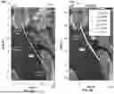 Fig. 09 - METHODS AND APPARATUS FOR NAVIGATION WITH POINT MASS FILTERS
