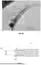 Fig. 06 - EXTERNAL WORKING CHANNELS FOR ENDOSCOPIC DEVICES
