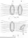 Fig. 02 - WIRELESS, BATTERYLESS BLOOD PRESSURE SENSOR IMPLANT